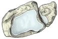 胫骨和腓骨（下面观）