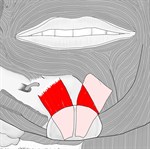 颏肌