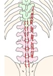 腰背部示意图,显示腰横突间内侧肌和腰棘间肌,附名称。