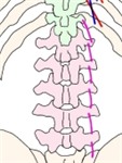 腰椎示意图，显示腰横突间外侧肌，附名称。
